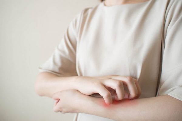 Understanding the Different Types of Eczema